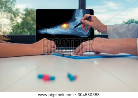 Doctor Showing A X-ray Of A Foot With Pain On The Top On A Laptop To A Woman Patient.