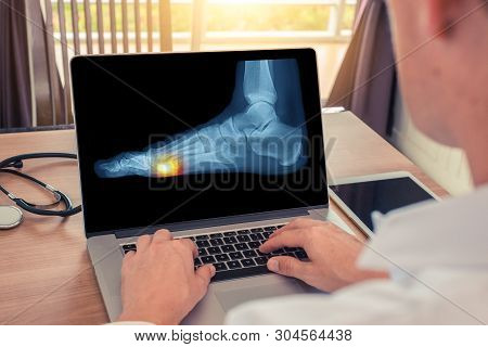 Doctor Watching A X-ray Of Pain Under A Foot.