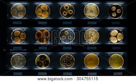 Different Samples With Kinds Of Bacterias Living At Common Household Items- Mattress, Shoe, Moisturi