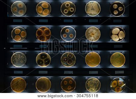 Different Samples With Kinds Of Bacterias Living At Common Household Items- Mattress, Shoe, Moisturi