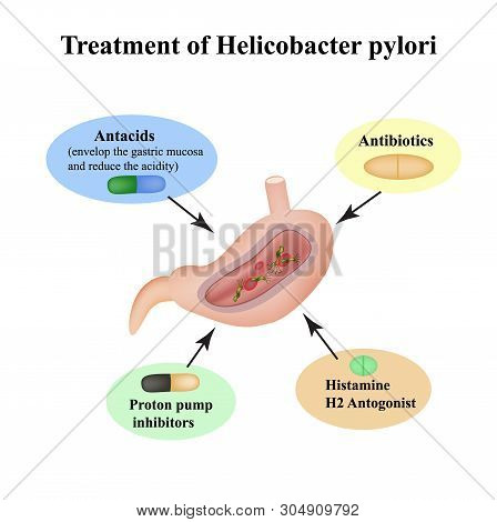 Treatment Of Helicobacter Pylori. Medications. Antacids, Proton Pump Blockers And H2-histamine Block