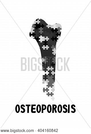 Medical Concept Of Osteoporosis Disease And Other Bone Ailments Vertical Black White Poster Bone Dam