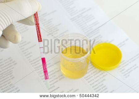 Urine amphetamine testing