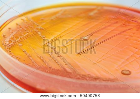 Orange Bacteria