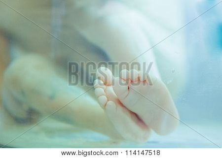Fetus in formalin solution