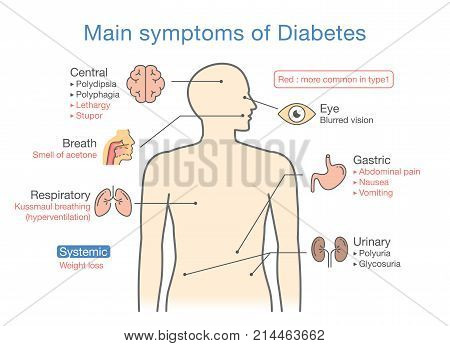 Main symptoms of Diabetes. Illustration about diagram for medical diagnosis of people disease.
