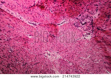 Cell Microscopic- Pyloric Division Stomach