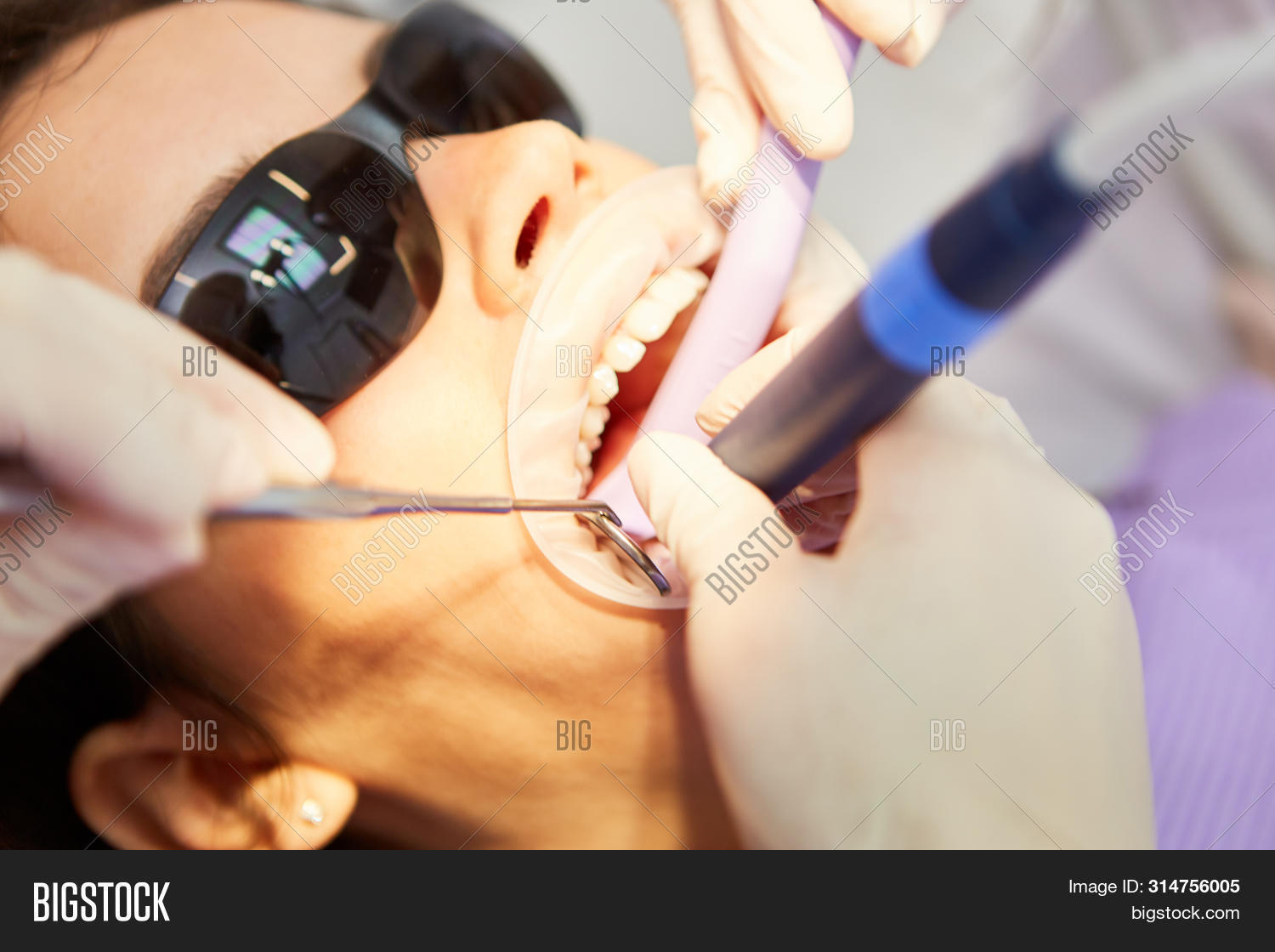 Dentist Drill Root Image & Photo (Free Trial) Bigstock