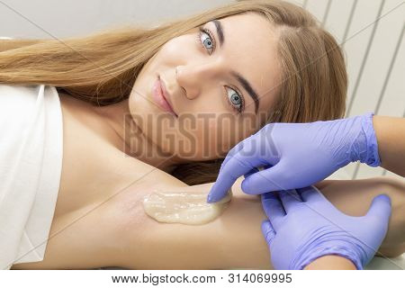 Sugaring: Epilation With Liquate Sugar At Armpit. Master Of Sugaring Making Hair Removal Procedure F