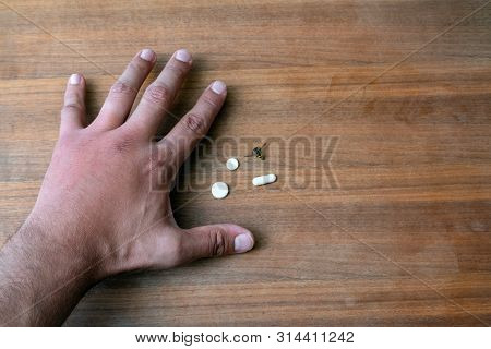 Male Hand Stung By Bee And Medication For Swelling Next To It. Hand Swelling, Inflammation, Redness