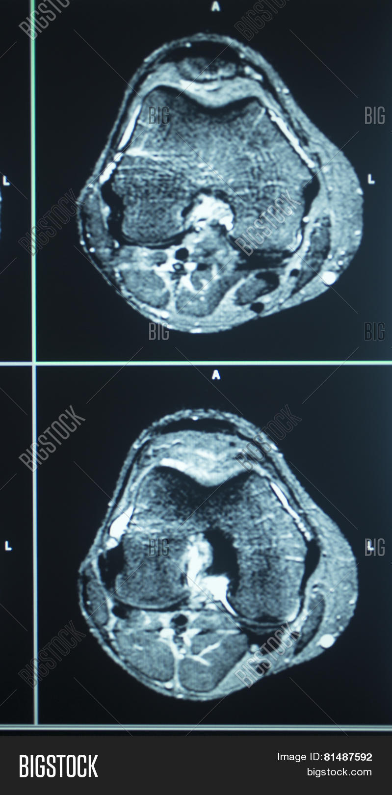 Mri Scan Test Results Image Photo Free Trial Bigstock Mri Scan Test Results Image Photo Free Trial Bigstock