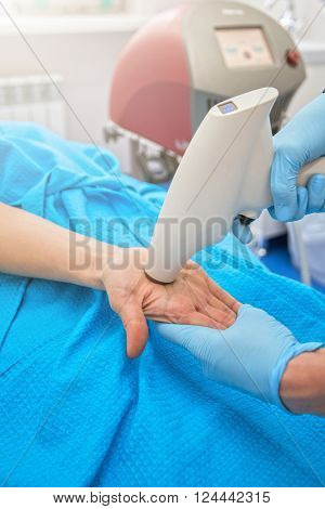 Procedure for palm against hyperhidrosis