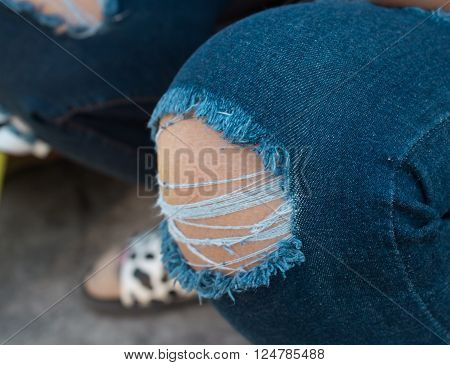 Torn jeans knee fashion, torn, tattered, skin