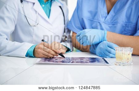 Portrait of female dentist and male surgeon examining teeth x-ray of a patient sitting at the desk in lab.