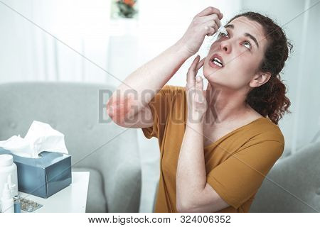 Woman With Scratch Marks On Her Elbow Using Eye Drops