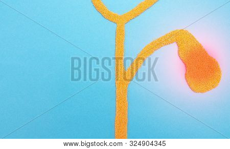 Bile Ducts And Gall Bladder From Plasticine On A Blue Background. Gallbladder Disease Concept And La