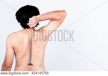 Back Of Man Using A Stick To Scratch The Back Help Scratch The Skin Itching Area From Dermatitis, On