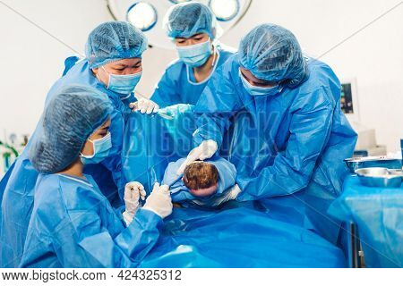 Professional Anesthesiologist Doctor Medical Team And Assistant Is Performing Baby Cesarean Section 
