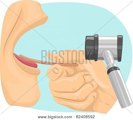 Illustration of a Man Undergoing an ENT Examination