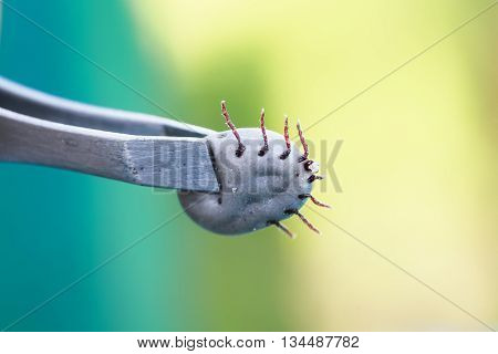 Insect inflated with blood the tick is pulled out metal tongs