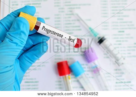 Test tube with blood sample for progesterone test