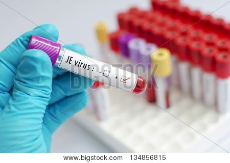 Blood sample positive with Japanese encephalitis (JE) virus