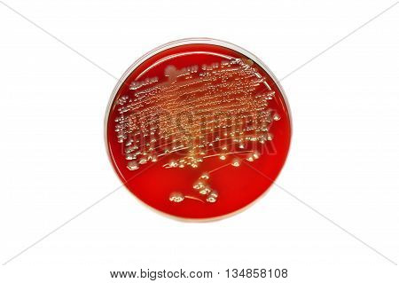 Colonies of bacteria in culture medium plate