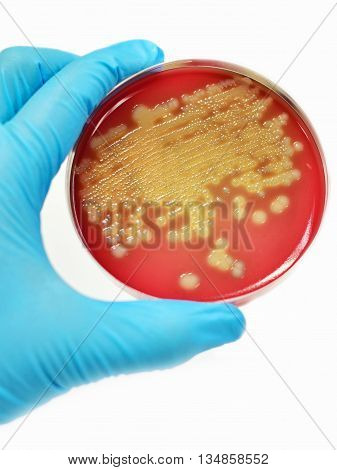 Colonies of bacteria in culture medium plate