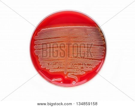 Colonies of bacteria in culture medium plate