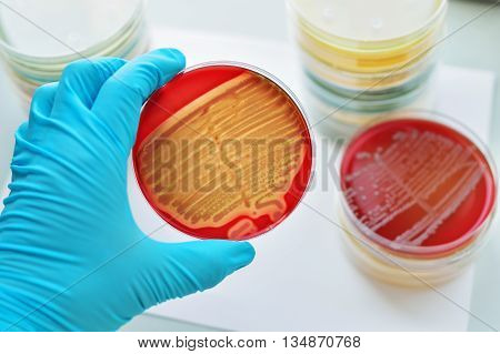 Colonies of bacteria in culture medium plate