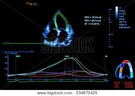 Colourful Image Of Modern Ultrasound Monitor. Ultrasonography Machine. High Technology Medical And H