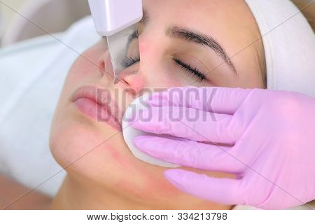 Cosmetologist Making Ultrasonic Face Cleaning Procedure On Nose For Young Woman In Clinic. Closeup C