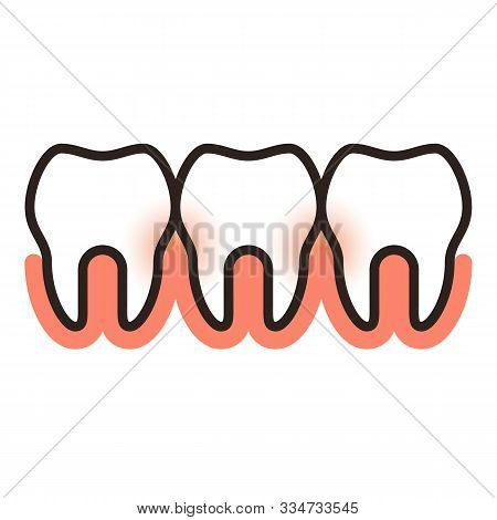 Paradontosis Symbol  Isolated On White Background - Vector Illustration