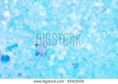 Slide Positive Acid Fast Bacilli.
