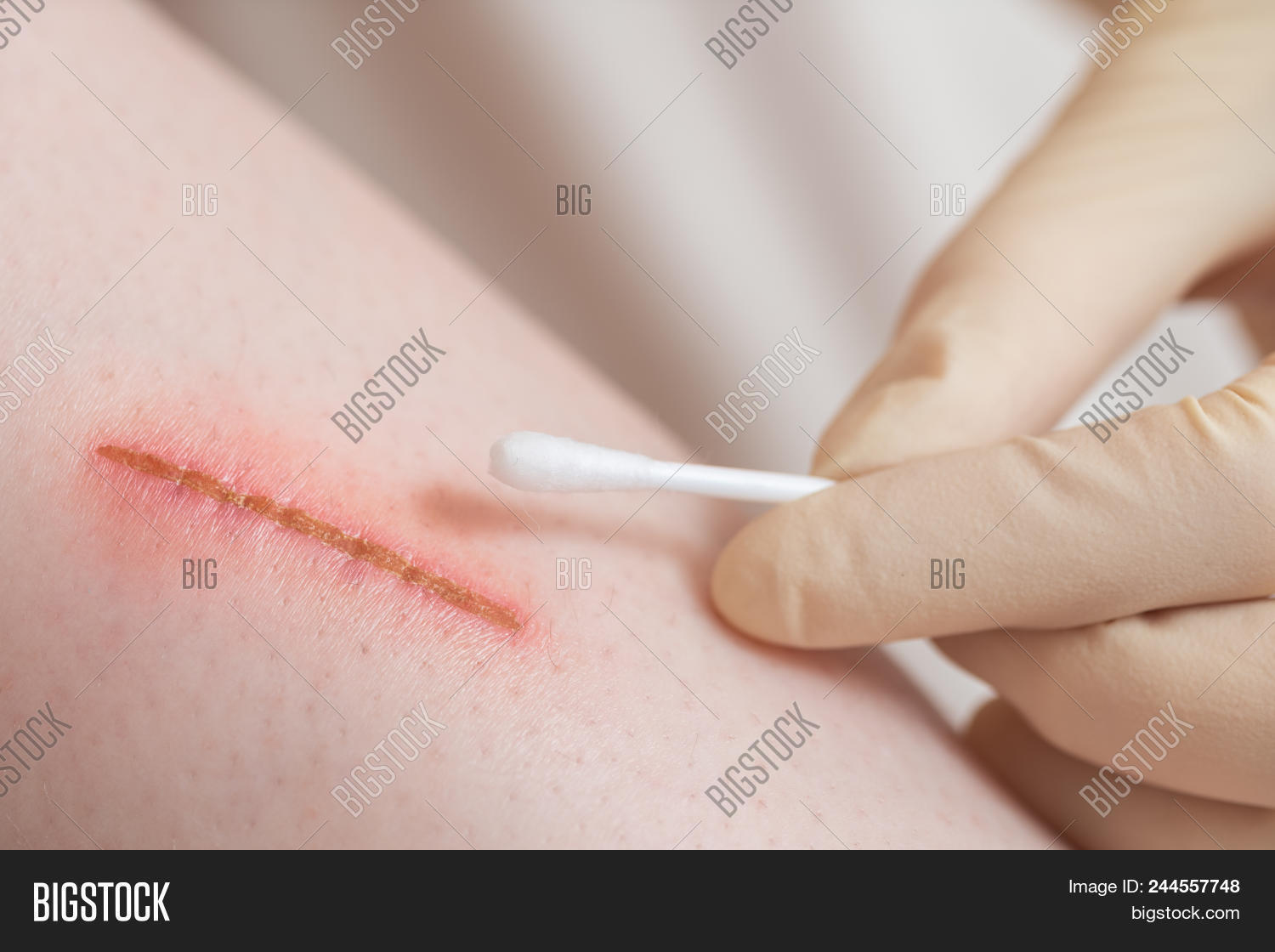 medical assistant image photo free trial bigstock emergency room medical assistant