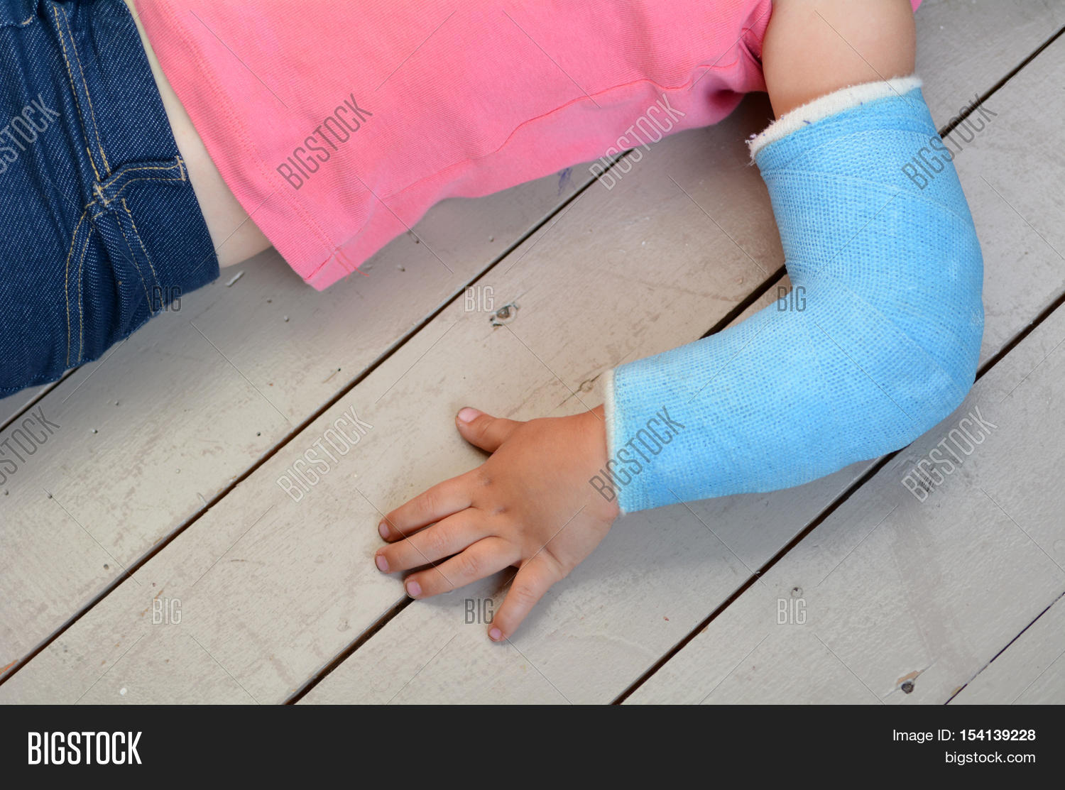 Child Arm Cast Image & Photo (Free Trial) Bigstock