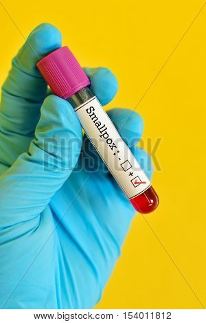Blood sample positive with smallpox virus test
