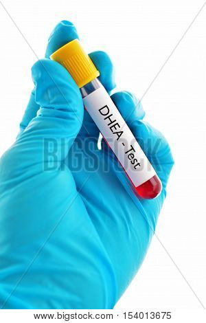Blood sample for DHEA (dehydroepiandrosterone) hormone test