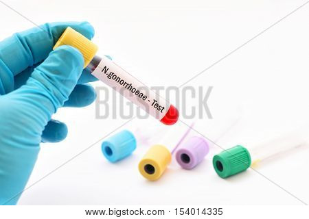 Test tube with blood sample for Neisseria gonorrhoeae test