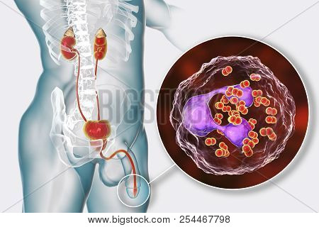 Male Gonorrhea, Medical Concept. 3d Illustration Showing Close-up View Of Neisseria Gonorrhoeae Bact