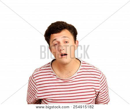 Slow Down And Tell Again. Sleepy Guy Feeling Puzzled And Having No Clue What Is Happening, Awakening