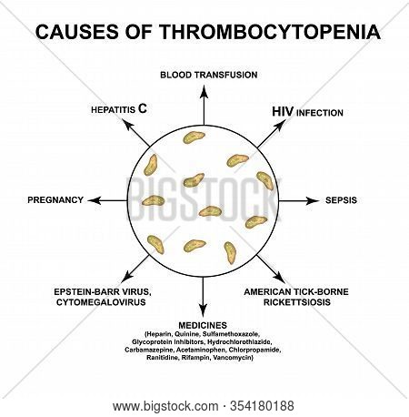 Causes Of Thrombocytopenia. Reducing Platelets In The Blood. Infographics. Illustration On Isolated 