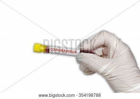 Covid-19 World Outbreak Concept With Coronavirus Tag On Vacutainer. Female Chemist With Protective G