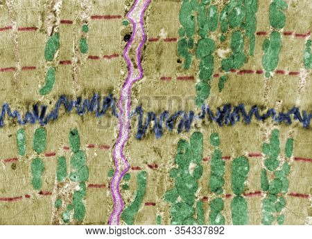 False Colour Electron Microscope Micrograph Showing An Intercalated Disc (blue) Between Heart Muscle