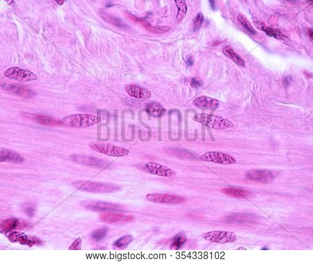 Smooth Muscle Fibers From The Wall Of A Small Intestine. The Folded Aspect Of The Nuclei Indicates T