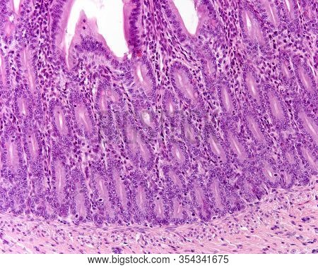 Bottom Of The Lieberkühn Crypts Of A Small Intestine Showing Numerous Mitosis That Appear As Black S