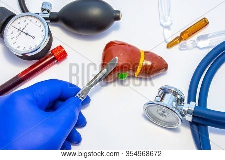 Concept Photo Of Liver Surgery, Operation Of Liver Resection Or Hepatectomy. Doctor With Scalpel In 