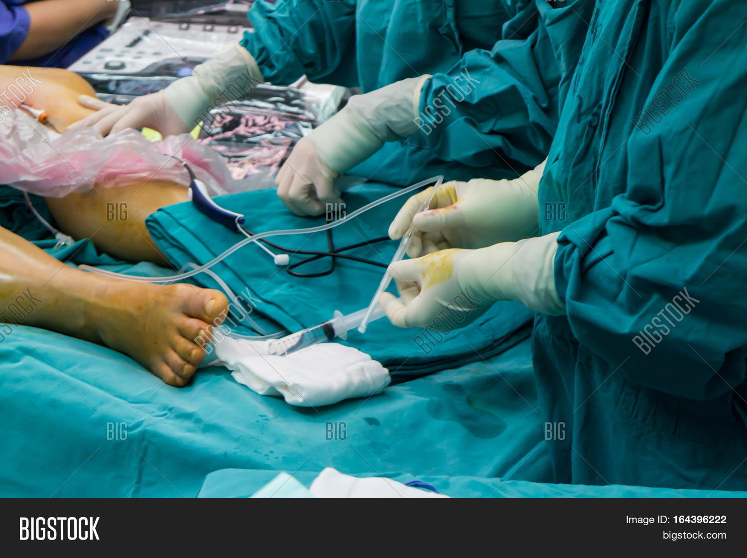 Doctor's Surgery Foot Image & Photo (Free Trial) Bigstock