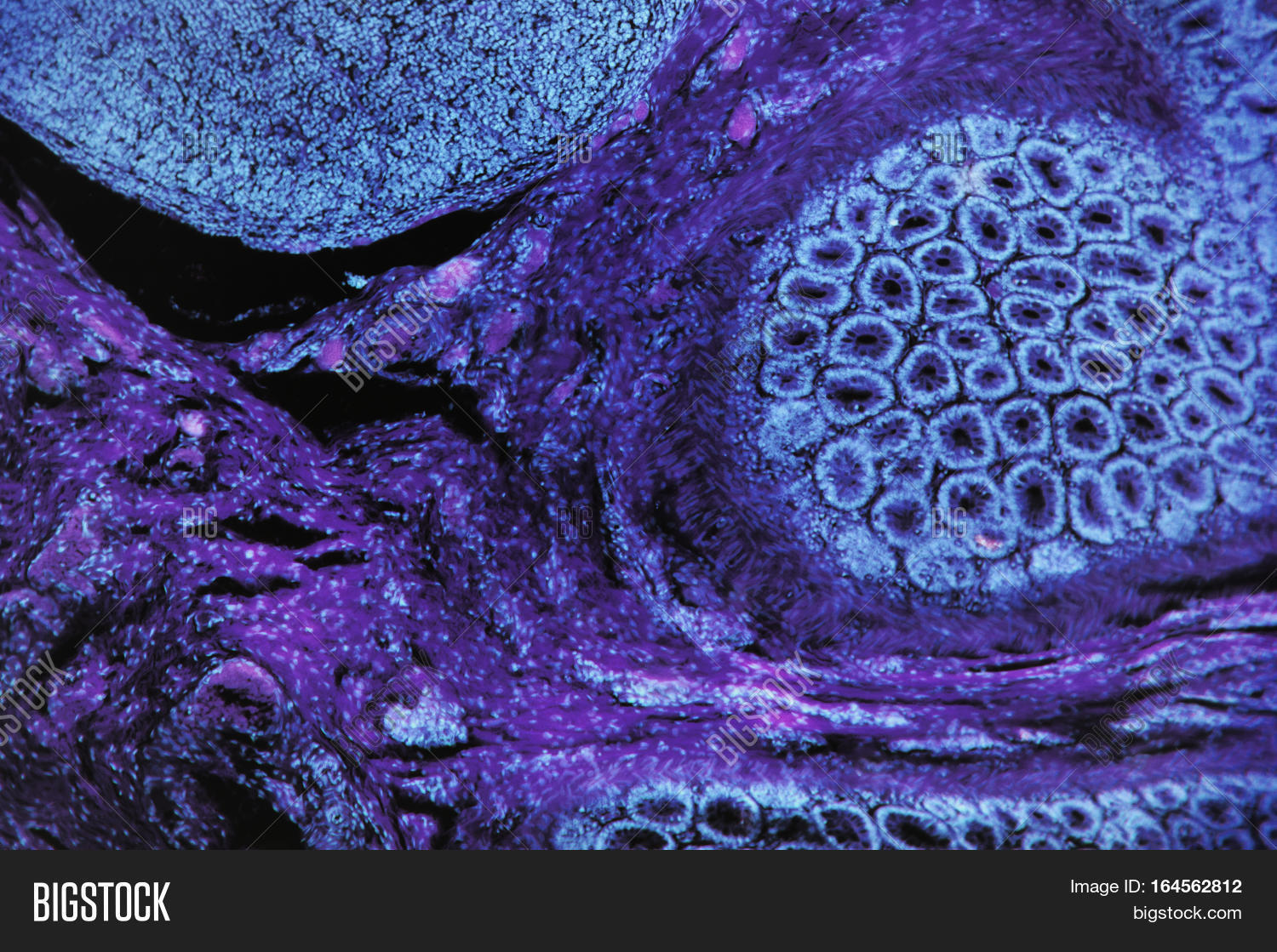 экстази монклер. розовые зрачки. аргироз пол карасон. фиолетовый негр. фиолетовые глаза.