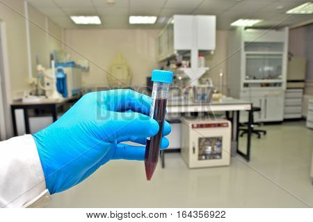 Laboratory examination of the blood. Vacuum tube with blood on the background of scientific equipment.